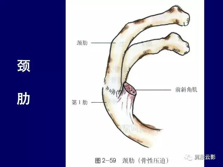 脱臼,齿状突骨折或缺失(张口位片;第七颈椎横突有无过长,有无颈肋