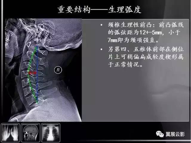 【骨肌组推荐】颈椎x线片阅读