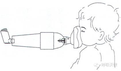 儿童哮喘宝典17:定量气雾剂 储雾罐使用方法