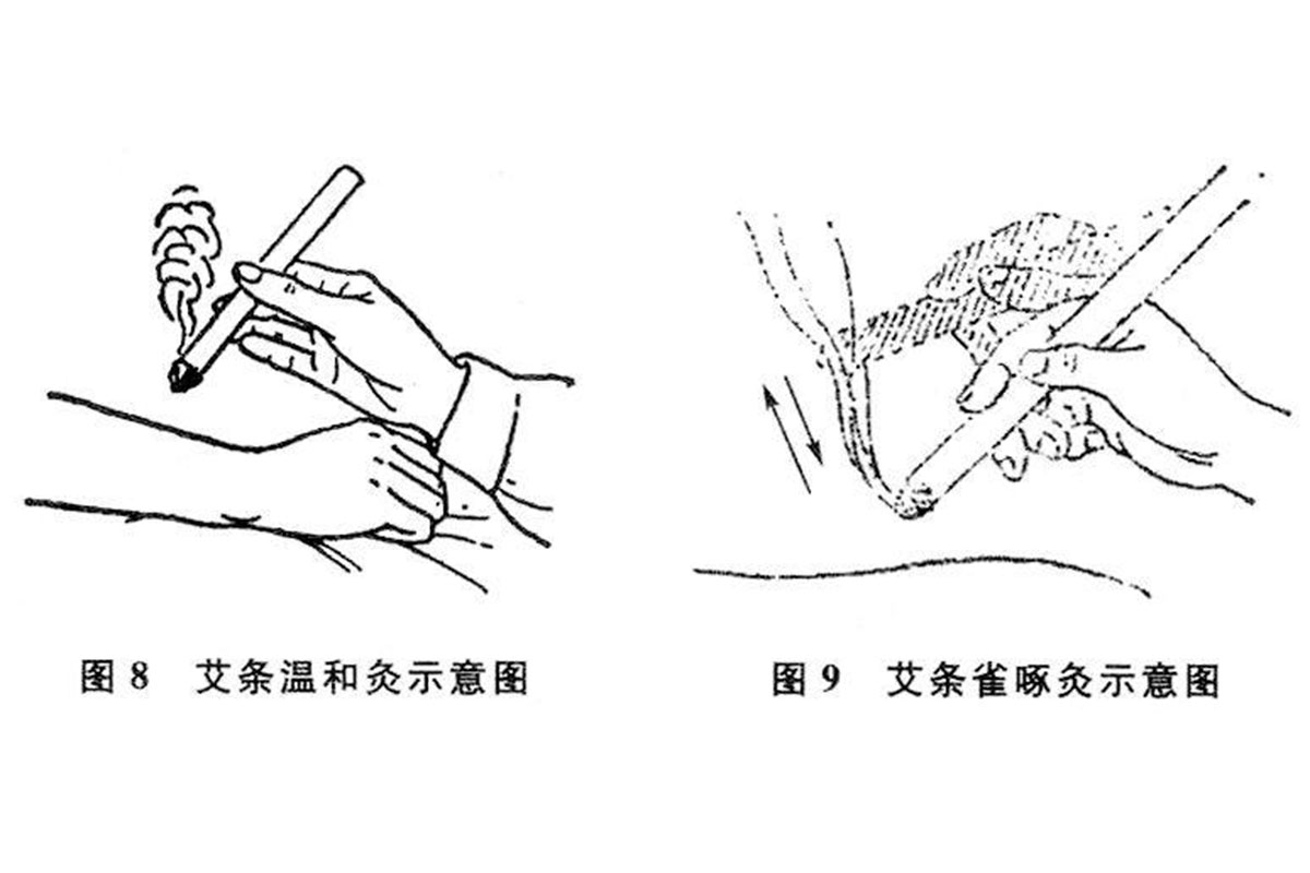 第一次艾灸时应该注意哪些问题呢？ .艾灸养生