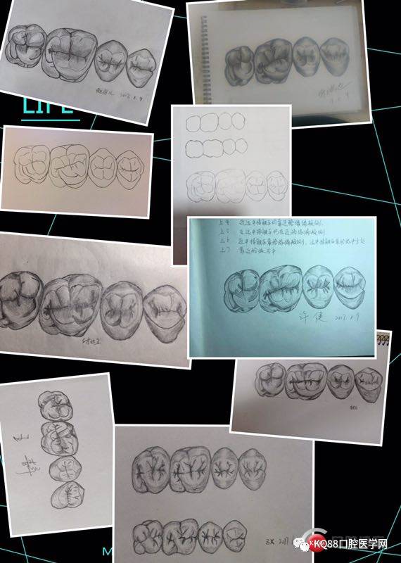 课题继续ing 画中切牙的宽长比,六个前牙的黄金比例,切外展间隙 唇面