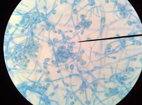 小孢子菌是宠物临床中较为常见的条件致病菌,可以长期存在而不致病.