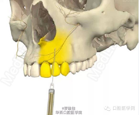 口腔麻醉美图