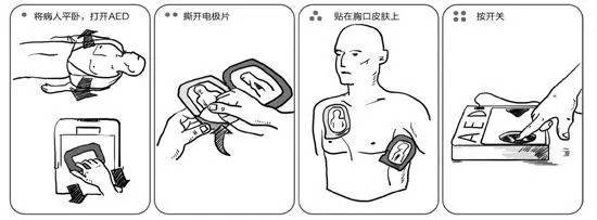 aed是 自动体外除颤仪的英文缩写 它是一种正在逐渐普及的急救设备