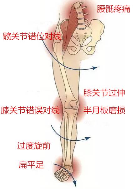 nmd鞋底磨损怎么办