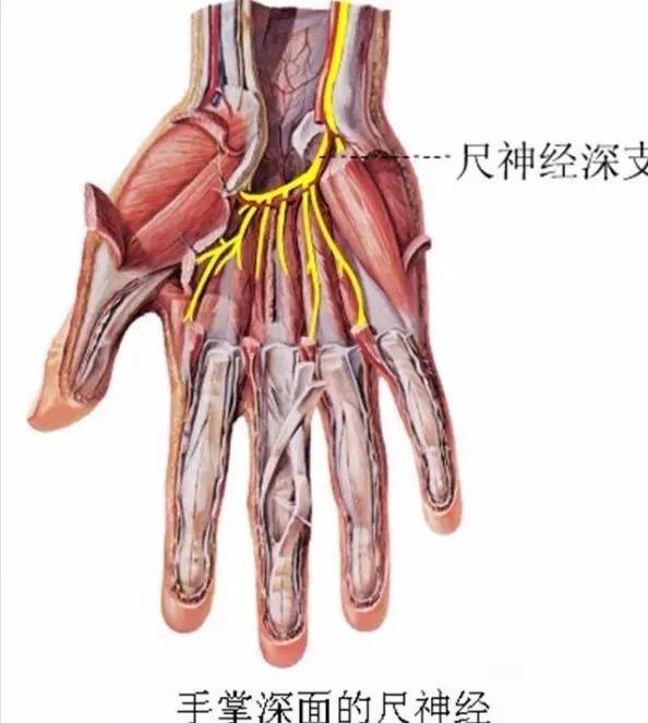 诊断标准    有桡神经损伤的症状及体征,伤侧的上肢垂腕,拇指不能背