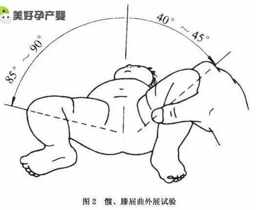 快检查一下:你家宝宝臀纹对称吗?