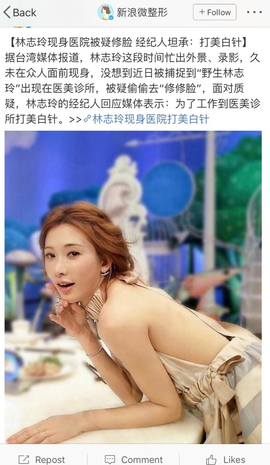 林志玲修脸黎姿脸僵,女星微整都变美了吗?