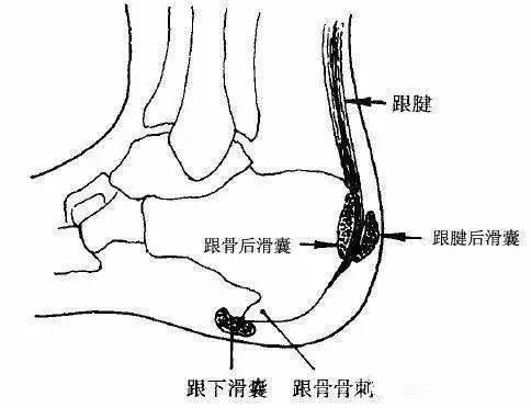 有时跟腱也会肿胀.通常会随着活动的进行疼痛感加剧.