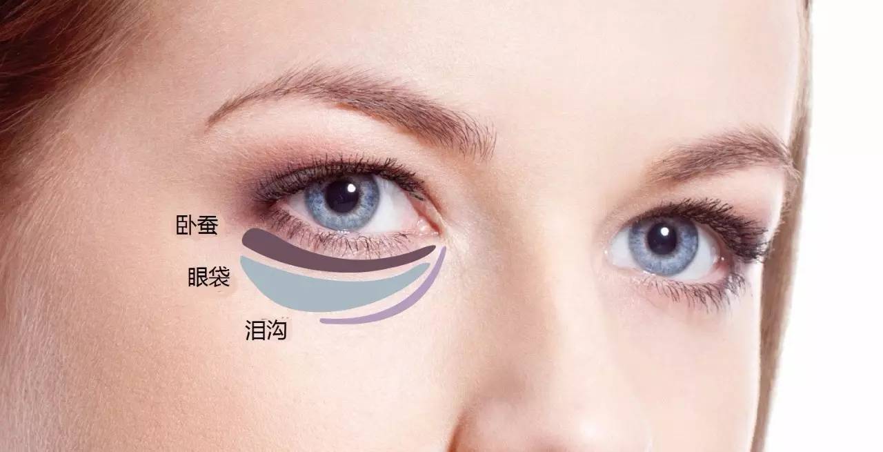 [健康科普]分清眼袋与"卧蚕" 眼科专家教你五招告别眼袋