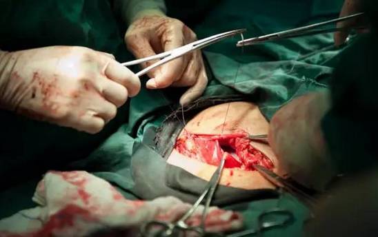 手术用的缝针是弯头的,这样便于操作