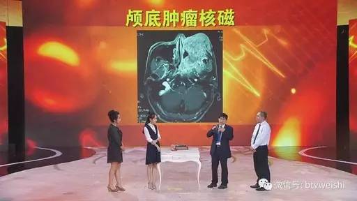节目视频万经海刘绍严主任为您讲述鼻出血背后的致命危机恶性脑瘤上