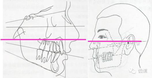 正文  鼻翼中点至耳屏中点的连线 与眶耳平面为150交角,与牙合 平面