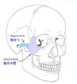 颧弓位于面中部的外侧,形成面颊部的骨性突起.