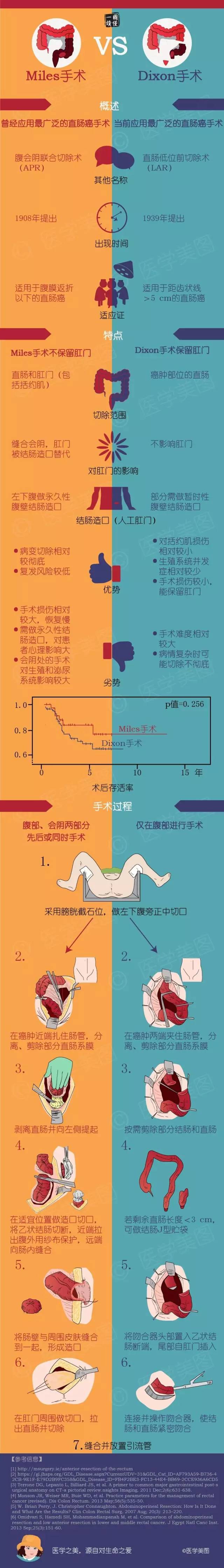 你知道miles手术和dixon手术的区别吗?