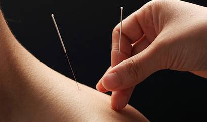 中医的放血疗法,是以针刺某些穴位或体表小静脉而放出少量血液的