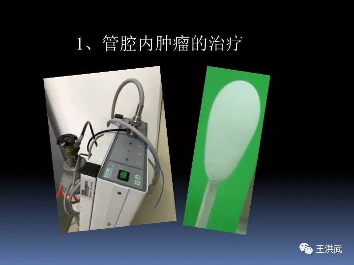 洪武讲堂丨co2冷冻在支气管镜下的应用