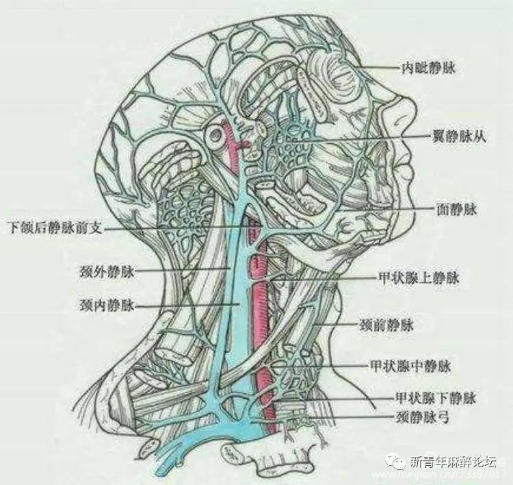 超声引导定位后"○"式标记应用于中心静脉穿刺置管术(颈内静脉)