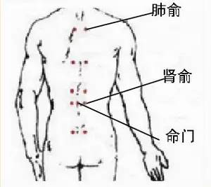 1.主要穴位:肾俞,气海俞,大肠俞,关元俞,腰俞,腰阳关,命门 2.