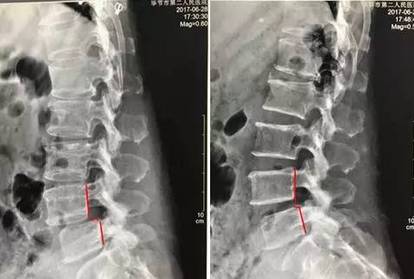 【三名工程】首都国医名师告诉你:脊柱疑难病不再疑