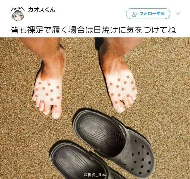 搞笑 正文  暑期温馨提示,穿洞洞鞋需谨慎. 责任编辑