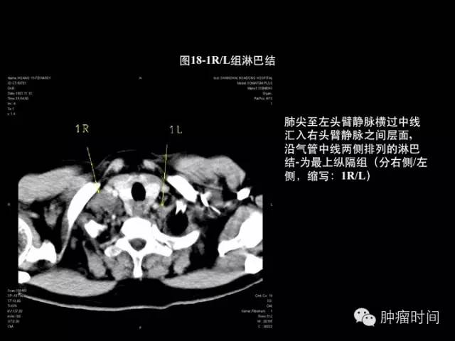 经典中的经典胸部ct断层肺叶分段各组淋巴结划分