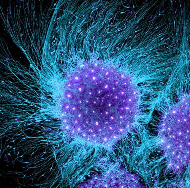 brivanlou  此图片为小鼠视网膜神经节细胞,在显微镜下