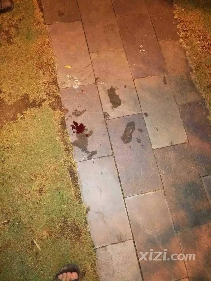谁在平山新广场乱扔玻璃渣?一街坊被扎伤流血