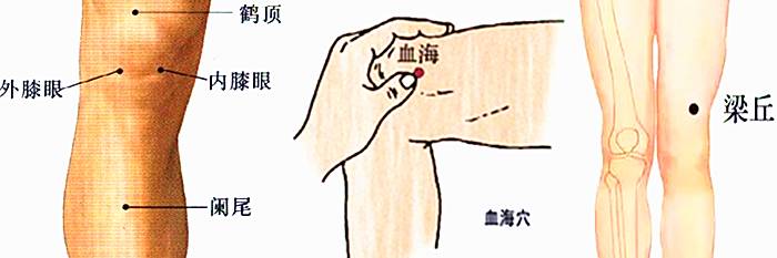 内外膝(膝盖窝下面两个眼),血海(膝盖上面两指内侧),梁丘(膝盖上两指