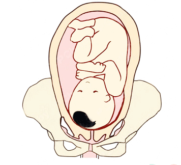 这种胎位将使产程拉长,令你在分娩期间背痛,可能需要辅助生产.