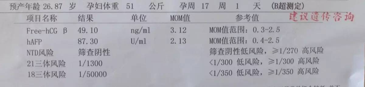 唐氏综合征到底离你的宝宝有多远?