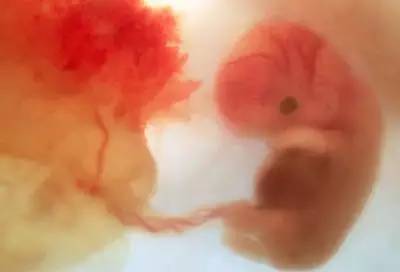 头占全身的一半,胚胎颜面已显现出来,有舌及尚未成熟的牙床,臂上已有
