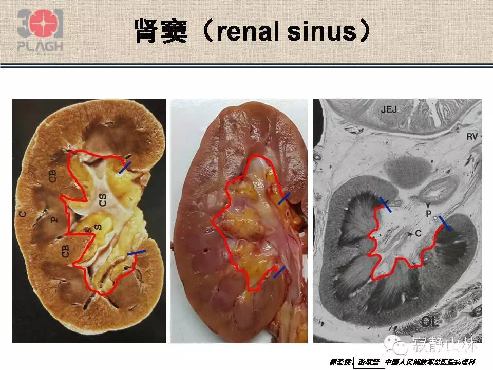 肾脏标本的病理操作常规