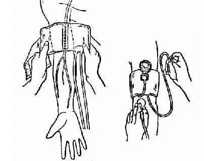 测量血压时气囊位置应该与右心房水平同高,坐位时右心房水平位于胸骨