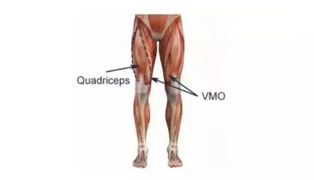 四头肌由股直肌,股中肌,股外肌和股内肌四个头组成,即大腿前侧肌肉群