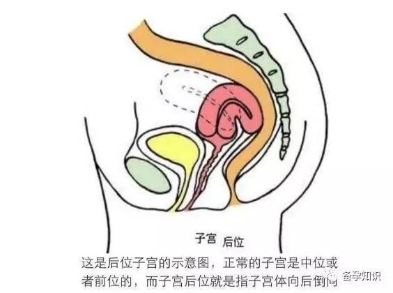 子宫前位,后位,对怀孕的影响大吗?