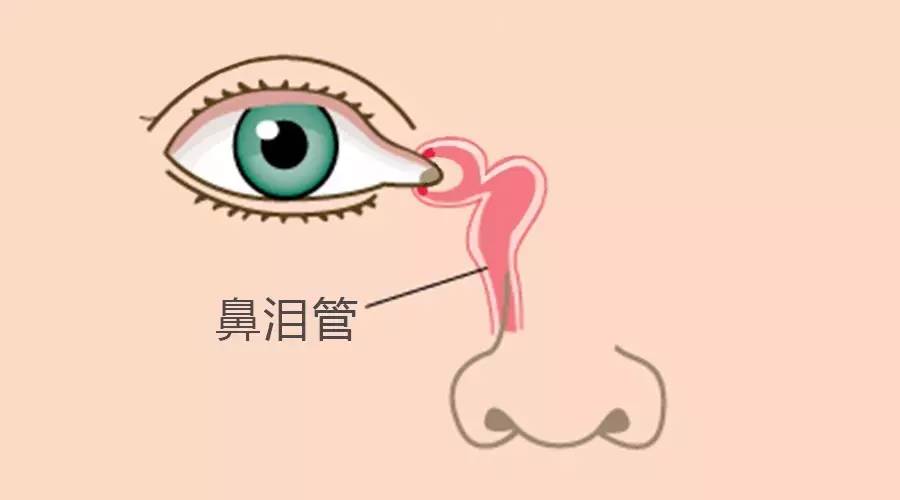 根据下图所示的鼻泪管所在位置,洗净手后,从眼角至鼻子方向,轻轻打圈