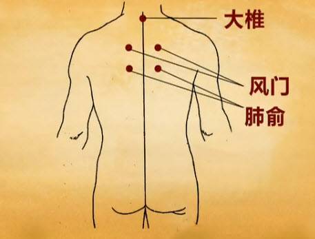 膝胸卧位原理是什么意思_膝卧位是什么姿势图片(2)