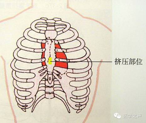 胸外按压频率