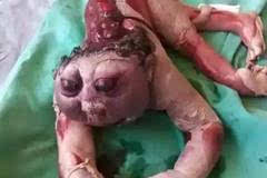 ufo | 女子生下"恐怖婴儿",在场所有医护人员都吓懵!