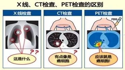 三分钟带你了解日本医疗旅游