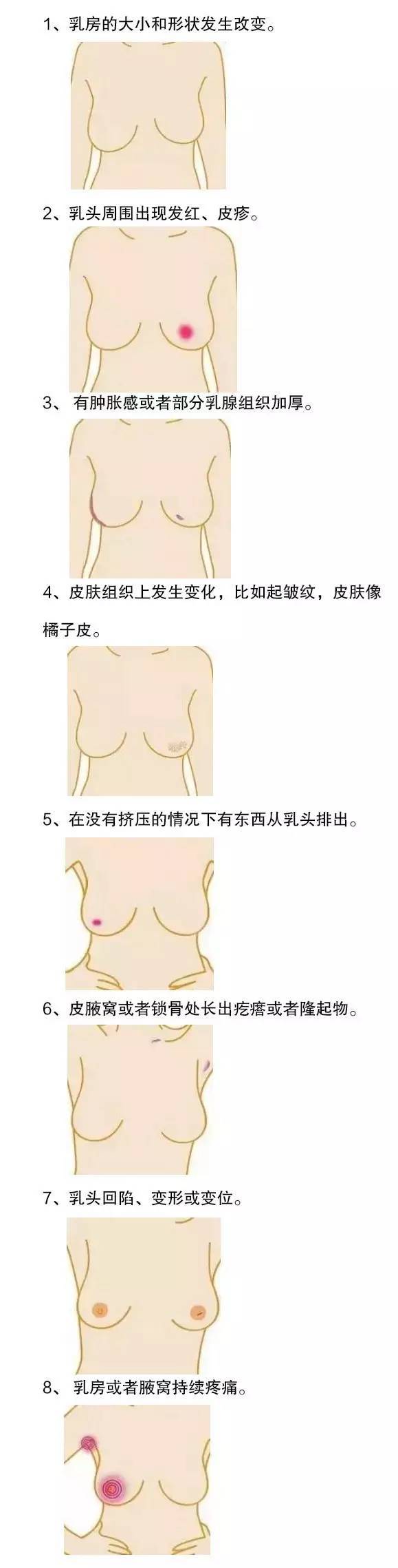 乳房是什么表面图片