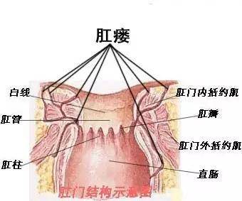 4,瘘管壁及瘘管内组织处理是否彻底