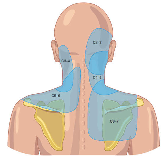 颈神经内侧支一般经过颈椎小关节的前外侧,在x线侧位片上通常位于关节