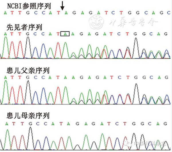 研究中心):患儿在scn5a基因第2外显子上发现一个框移突变(移码突变),y