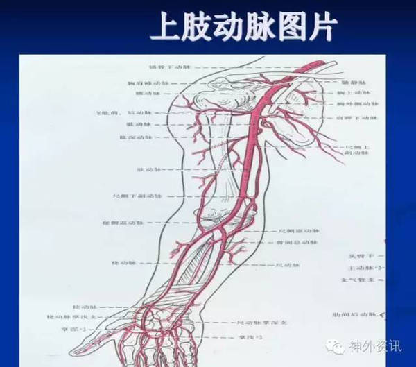 桡动脉到冠脉的路径图图片