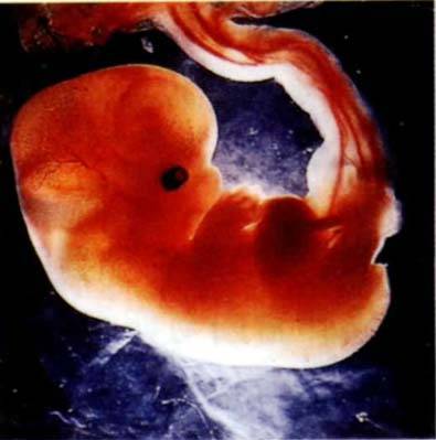 孕10周胎儿真人图片图片