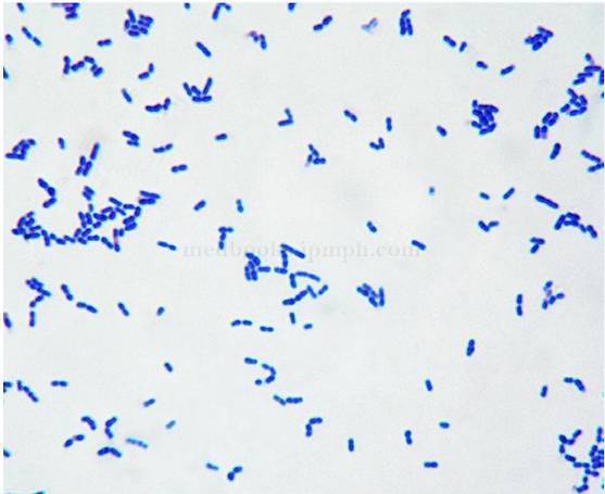 李斯特菌显微镜下形态