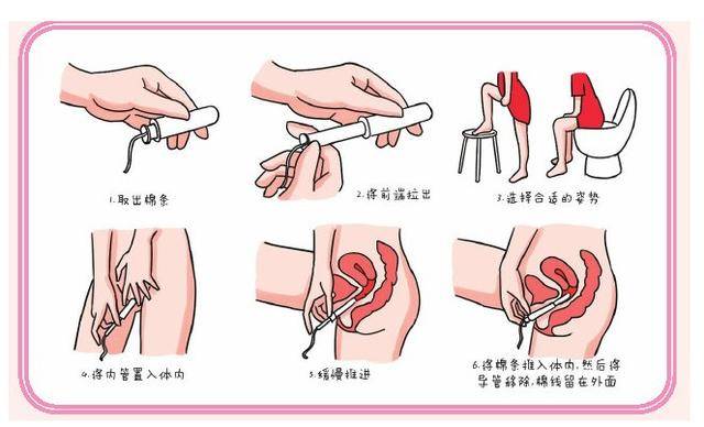 用衛生棉條會有異物感嗎塞進去會痛嗎