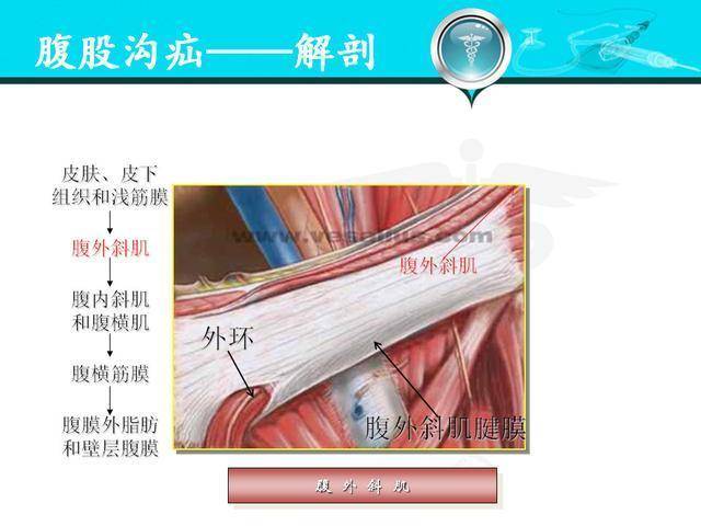 腹股沟管和股管图片